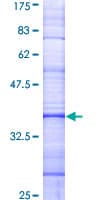 Human TAS2R14 / TRB1 Protein (Recombinant GST, N-terminus)