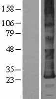 DERL2 / Derlin-2 Protein (Over-Expression Lysate Myc-DDK (Flag))