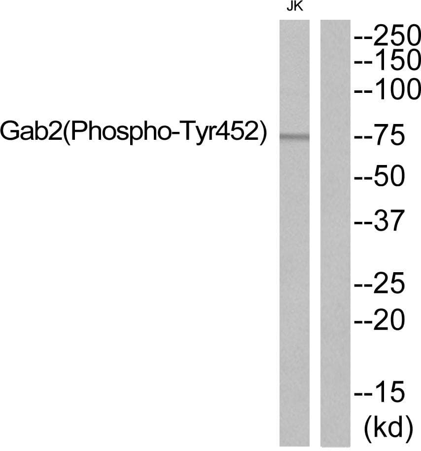 GAB2 Antibody (phospho-Tyr452)