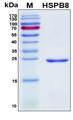 Human HSPB8 / H11 / HSP22 Protein (Recombinant His, N-Terminal)