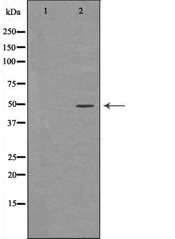 Polyclonal Rabbit anti-Human RBBP4 / RBAP48 Antibody (IHC, WB)