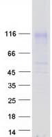 Human MFSD6 Protein (Recombinant Myc-DDK (Flag))