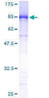 Human TCP1 Protein (Recombinant GST)