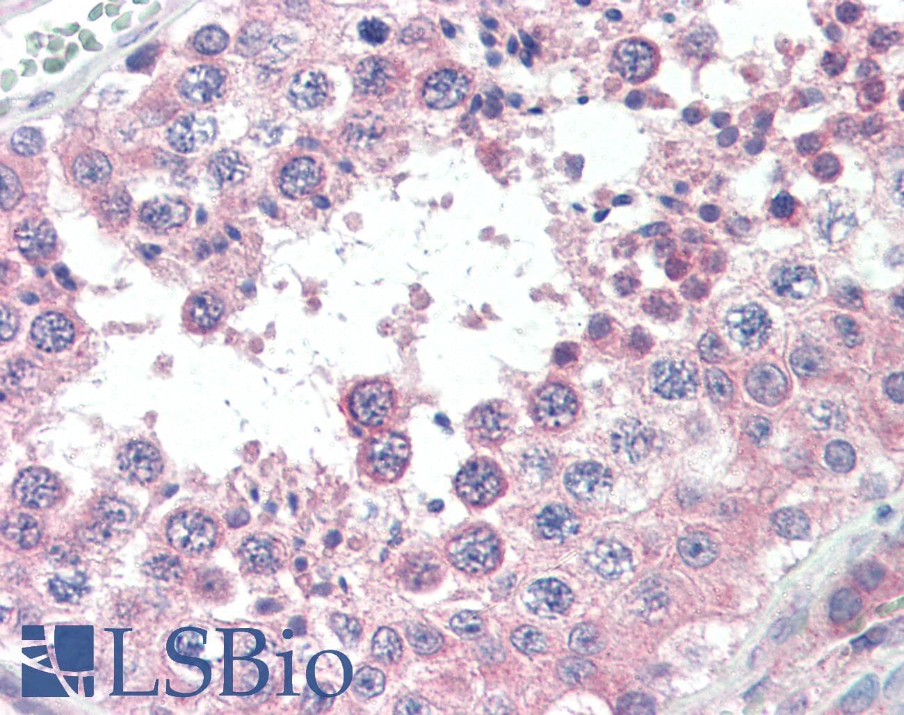 IHC-plus™ SLC3A2 / CD98 Heavy Chain Antibody (clone 44D7)