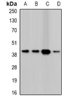 Polyclonal Rabbit anti-Human TWF2 / PTK9L Antibody (WB)