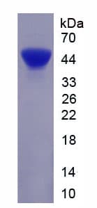 Mouse KRT18 / CK18 / Cytokeratin 18 Protein (Recombinant His, N-Terminal)
