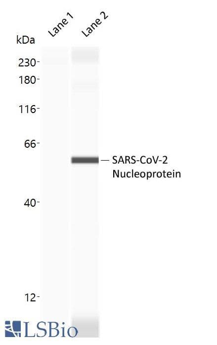 SARS-CoV-2 Nucleoprotein Antibody
