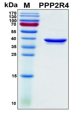Human PPP2R4 Protein (Recombinant His, N-Terminal)