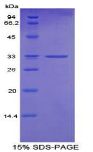 Mouse CYP24 / CYP24A1 Protein (Recombinant His-T7)