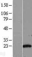 AK6 / Adenylate Kinase 6 Protein (Over-Expression Lysate Myc-DDK (Flag))