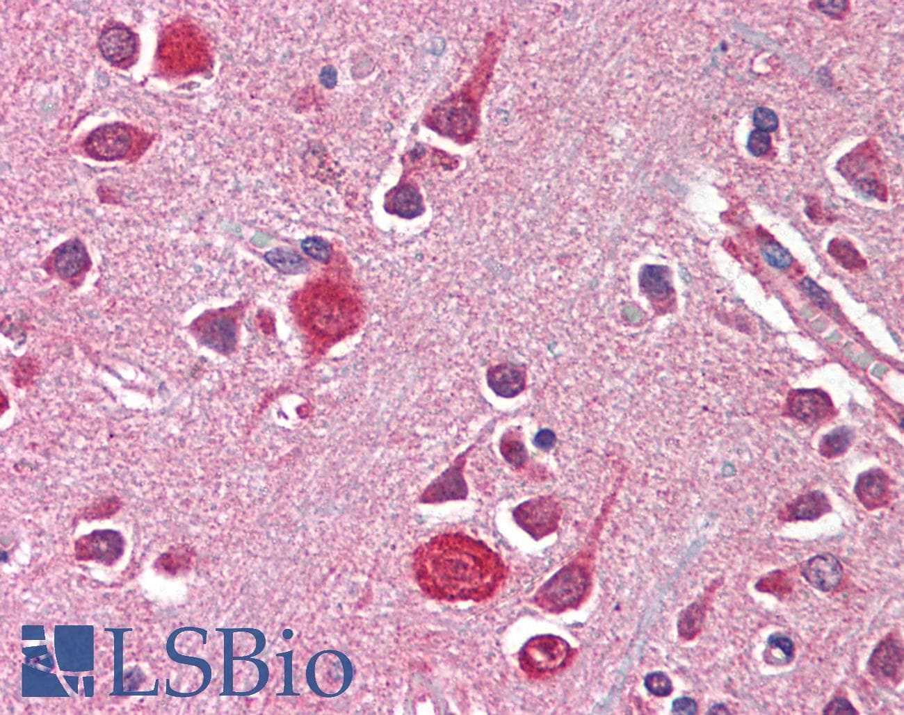IHC-plus™ AGAP2 / PIKE Antibody