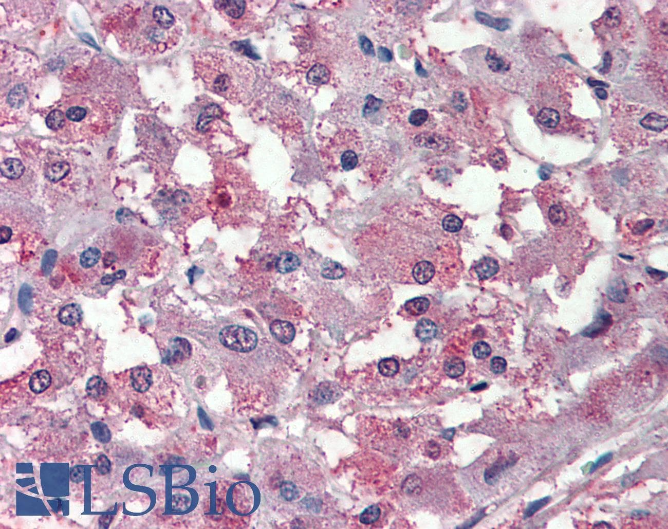IHC-plus™ Polyclonal Rabbit anti-Human THEM6 / C8orf55 Antibody (Internal, IHC)