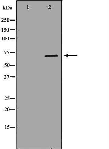 Polyclonal Rabbit anti-Human PCK1 Antibody (IHC, WB)