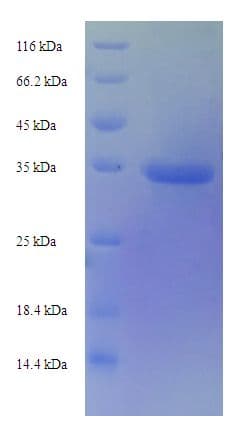 Mouse TIMP1 Protein (Recombinant His-SUMO)