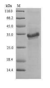Aspergillus fumigatus PRDX3 / Peroxiredoxin 3 Protein (Recombinant 6His-SUMO, N-terminus)