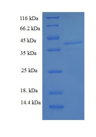 Human Junctin / ASPH Protein (Recombinant His-SUMO)
