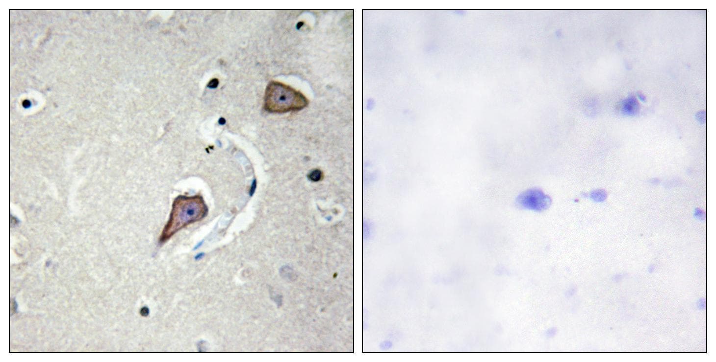 ERBB2 / HER2 Antibody (p686)
