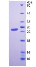 Human HAVCR2 / TIM-3 Protein (Recombinant His-T7)