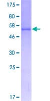 Human COMTD1 Protein (Recombinant GST)
