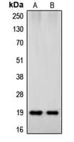 SNCB / Beta-Synuclein Antibody (C-Terminus)