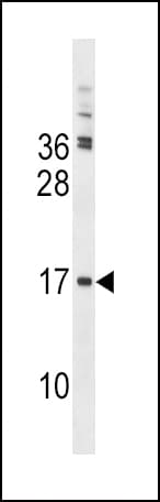 TSC22D3 / GILZ Antibody (aa62-91)