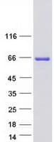 Human IRF5 Protein (Recombinant Myc-DDK (Flag))