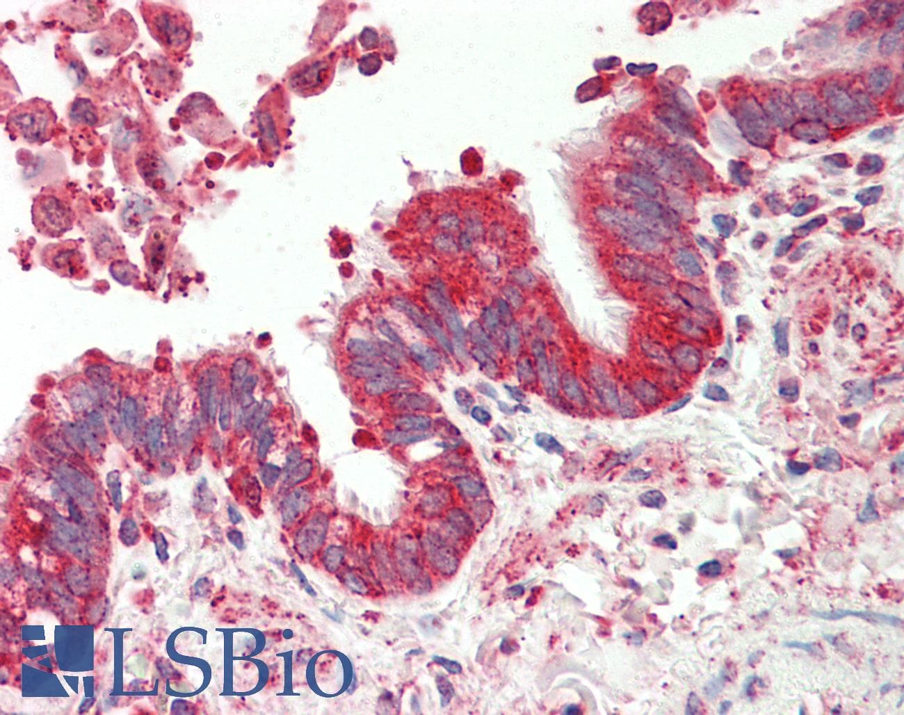 TSPAN12 Antibody (aa185-234)