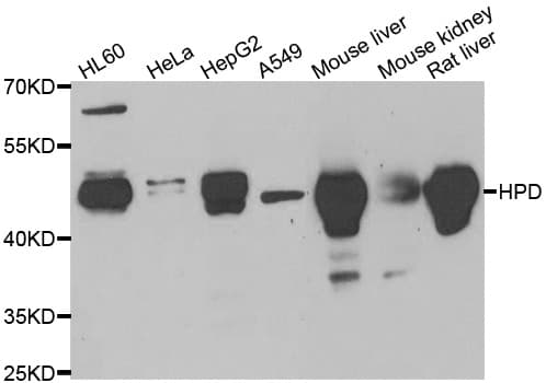 Polyclonal Rabbit anti-Human HPD Antibody (IHC, IF, WB)