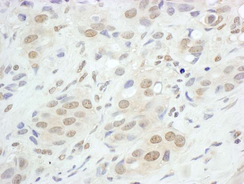 JUNB / JUN-B Antibody (aa40-80)