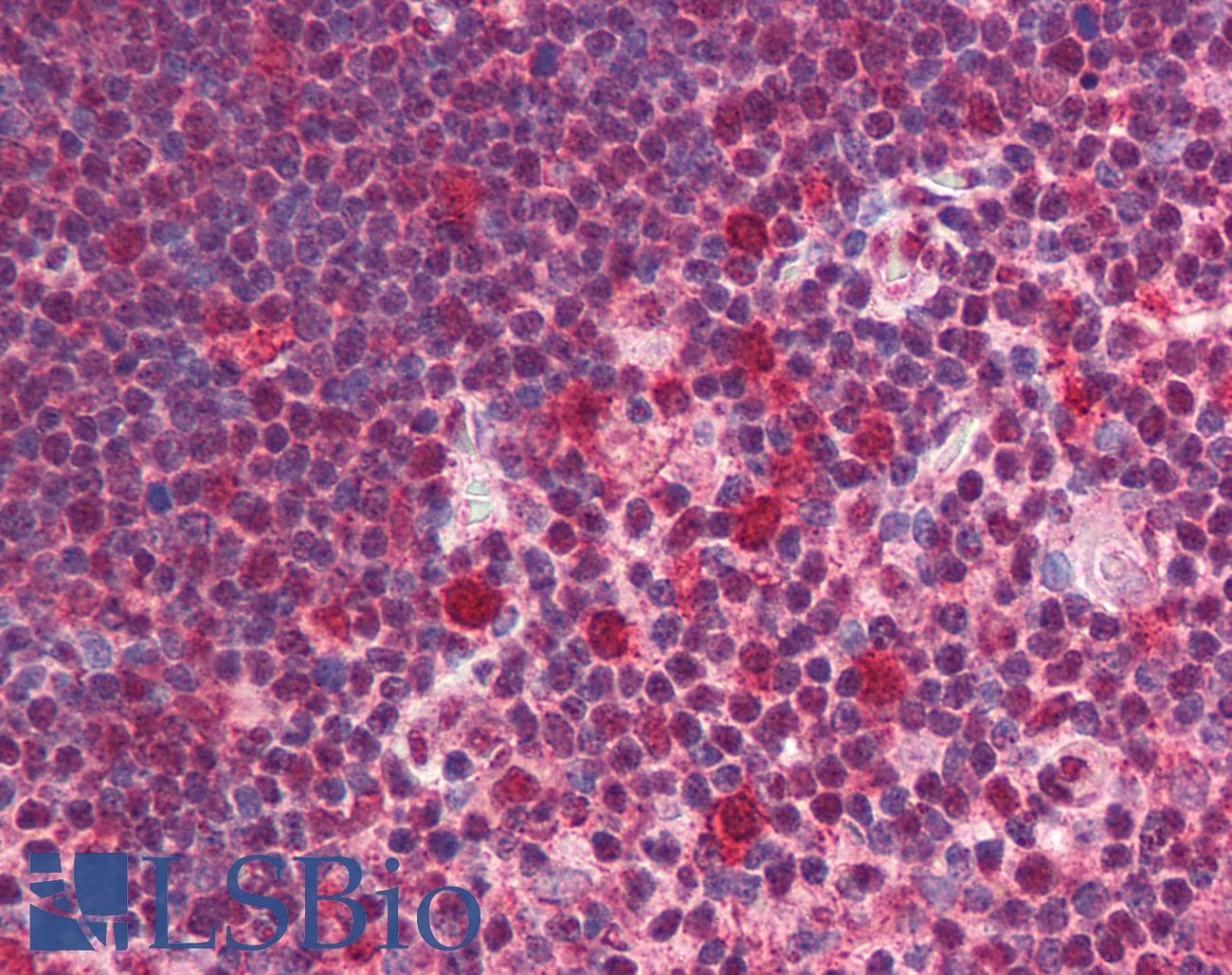 IHC-plus™ SNW1 / SKIP Antibody