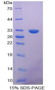 Mouse NOSTRIN Protein (Recombinant His-T7)