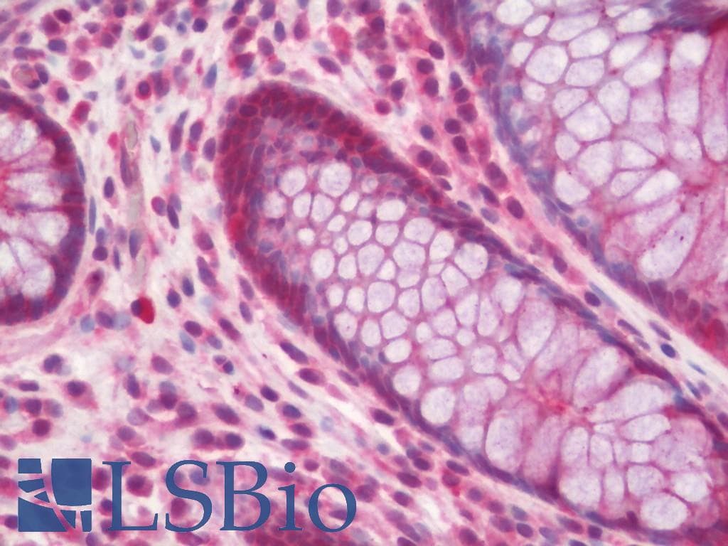 PathPlus™ ACHE / Acetylcholinesterase Antibody (aa536-585)