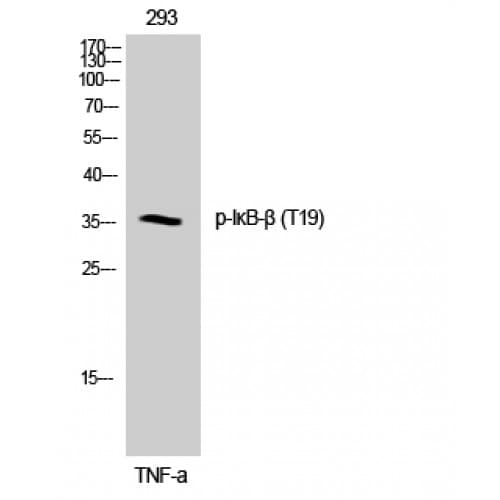 Polyclonal Rabbit anti-Human NFKBIB / IKB Beta / IKBB Antibody (1-80 aa, IHC, WB)