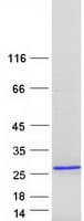 Human TNNI2 Protein (Recombinant Myc-DDK (Flag))