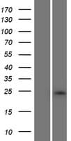RNF222 Protein (Over-Expression Lysate Myc-DDK (Flag))