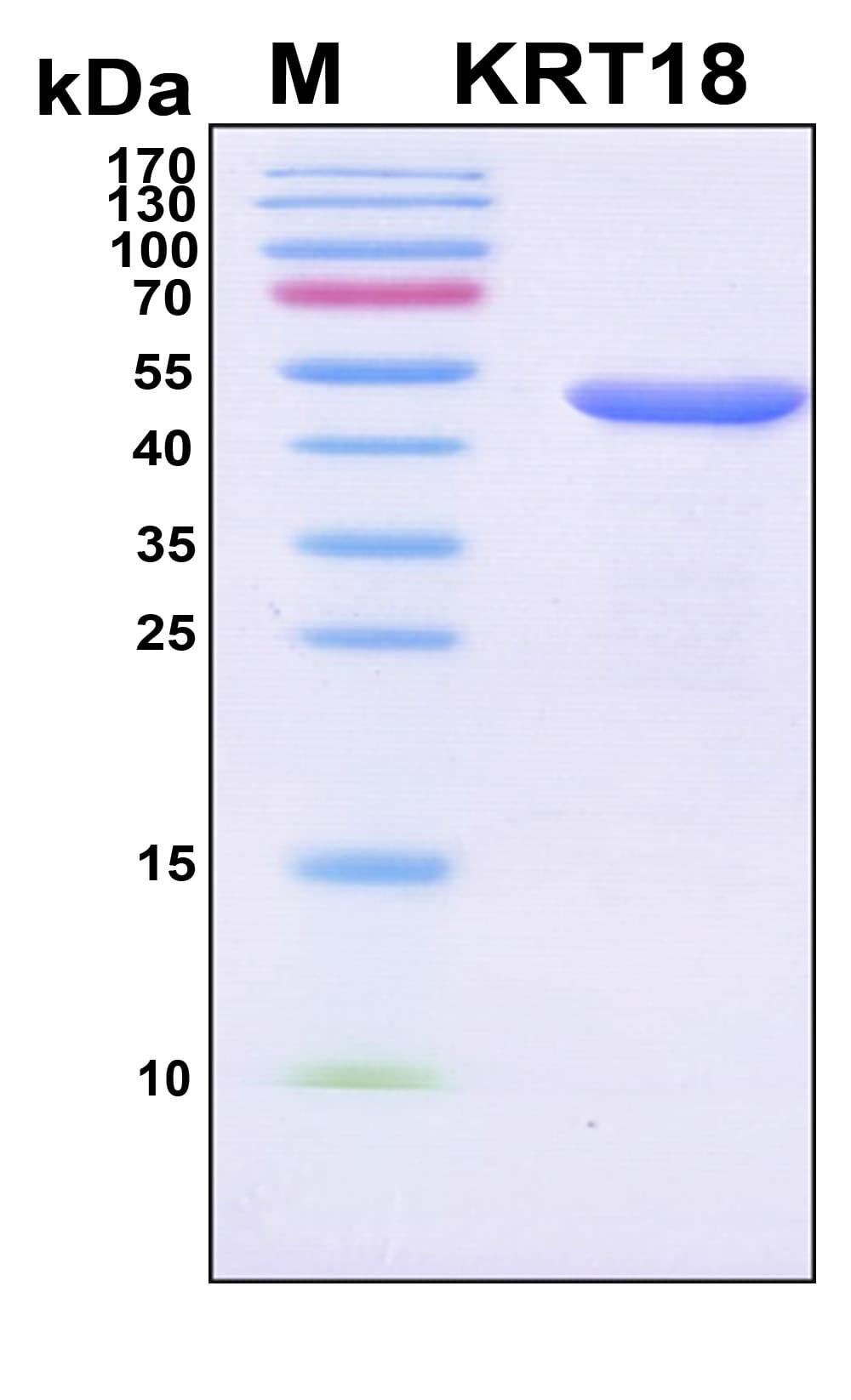 Human KRT18 / CK18 / Cytokeratin 18 Protein (Recombinant 6His, N-terminus)