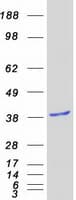 Human GIPC2 Protein (Recombinant Myc-DDK (Flag))