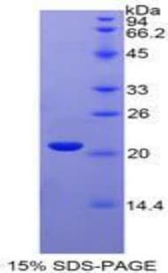 Human IFNA4 / Interferon Alpha 4 Protein (Recombinant His)