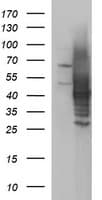 SHBG Antibody (clone OTI1G2)