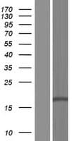 DLEU7 Protein (Over-Expression Lysate Myc-DDK (Flag))