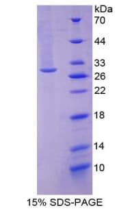 Mouse GGT1 / GGT Protein (Recombinant His-T7)