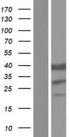 ETFB Protein (Over-Expression Lysate Myc-DDK (Flag))
