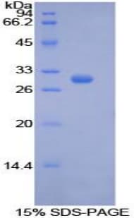 Human PCK1 Protein (Recombinant His-T7)