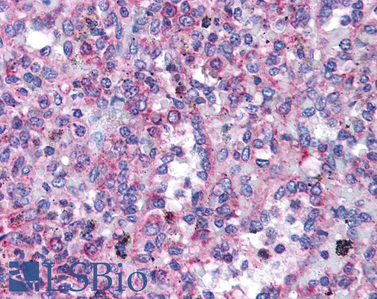 IHC-plus™ Polyclonal Rabbit anti-Human TRPC3 Antibody (IHC, WB)