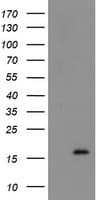Monoclonal Mouse anti-Human TSC22D1 / TSC22 Antibody (clone OTI4F1, IHC, WB)