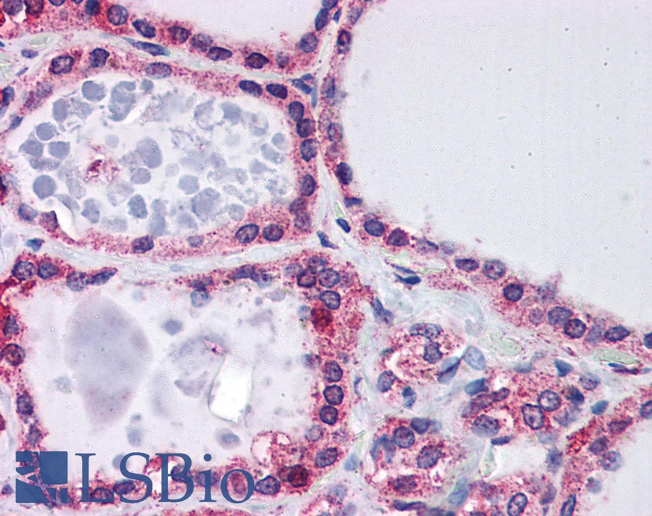 FXN / Frataxin Antibody (aa105-154)