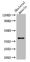 Polyclonal Rabbit anti-Human SLC29A1 / ENT1 Antibody (IHC, IF, WB)