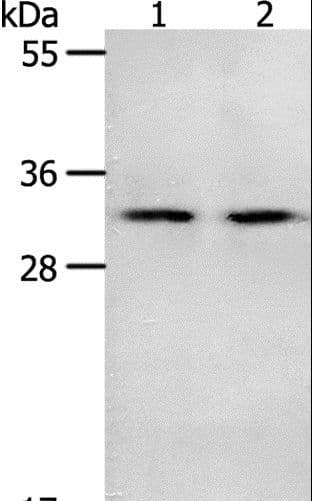 Polyclonal Rabbit anti-Human NME6 Antibody (WB)