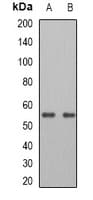 Polyclonal Rabbit anti-Human PNPLA2 / ATGL Antibody (WB)