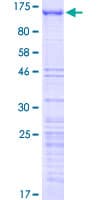 Human GNL2 Protein (Recombinant GST)